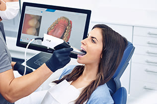 PrimeScanによる光学印象