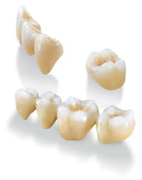 金属を極力使用しない治療を